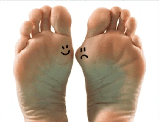 Bunion treatment
